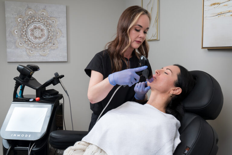 Morpheus8 RF microneedling treatment at Balanced Body in Kaysville, Utah